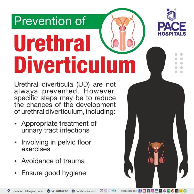 Preventions of Urethral diverticulum Preventions of Urethral diverticulum | Urethral diverticulum Preventions | Urethral diverticulum preventive measures | Visual depicting the Preventive measures of urethral diverticulum