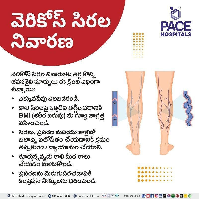 Varicose veins preventive measures in Telugu Varicose veins preventive measures in Telugu | తెలుగులో అనారోగ్య సిరలు నివారణ చర్యలు | అనారోగ్య సిరలు నిరోధించడానికి ఎలా | how to prevent varicose veins in Telugu | preventions of varicose veins in Telugu | అనారోగ్య సిరలు నివారణ