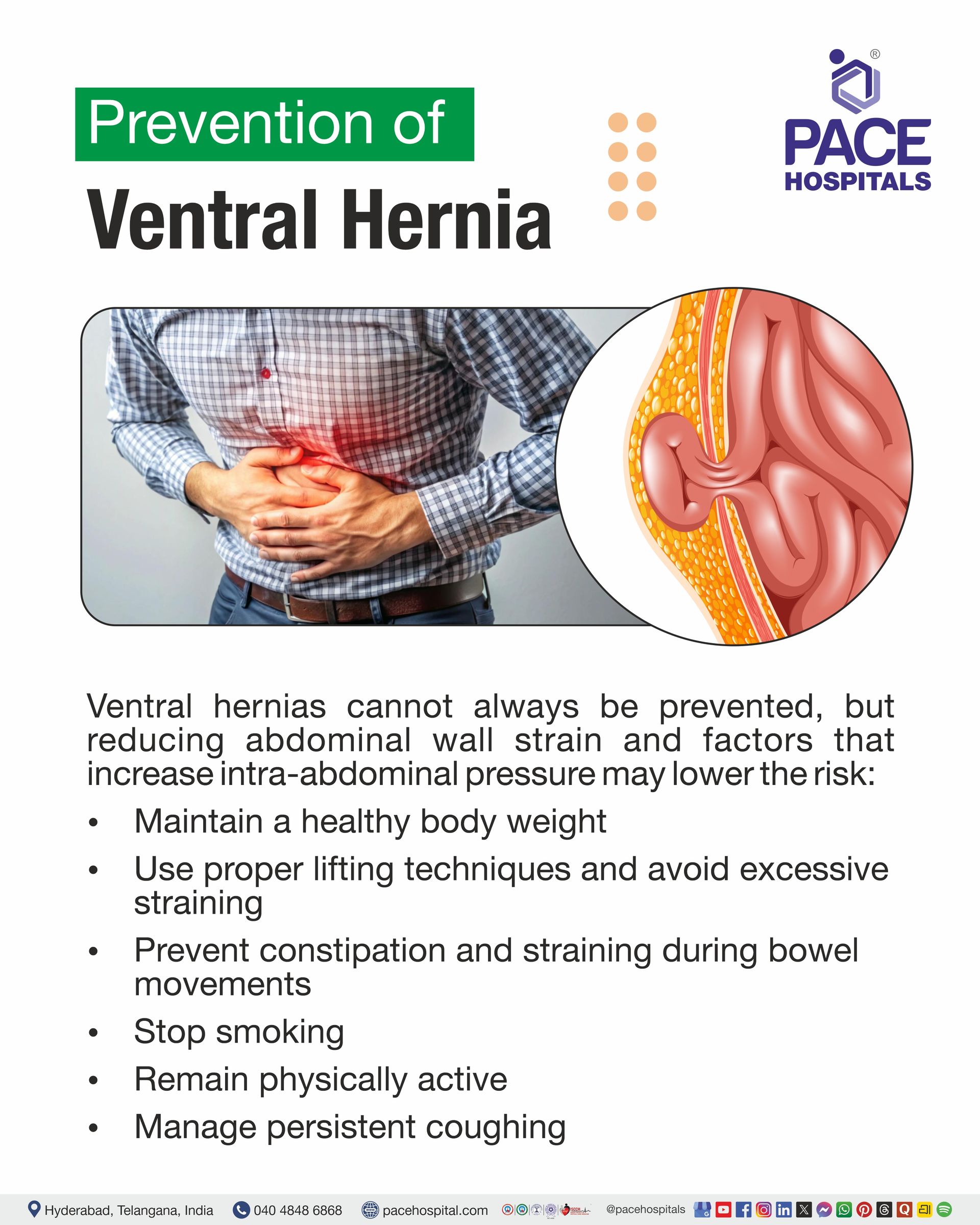 Prevention of Ventral Hernia Prevention of Ventral Hernia I Ventral Hernia Prevention