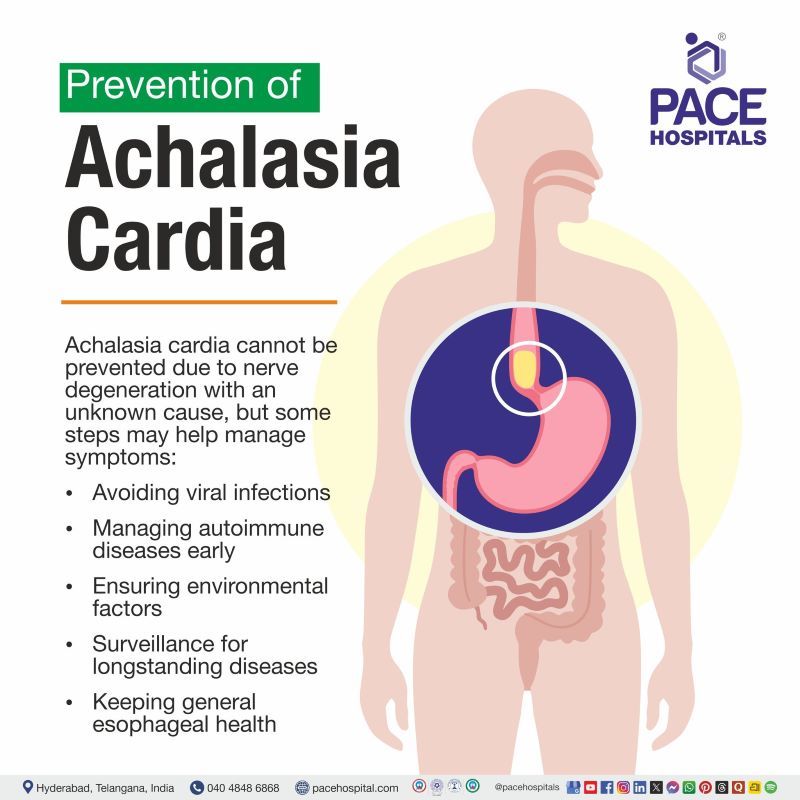 Achalasia Cardia Prevention | Prevention of Achalasia Cardia