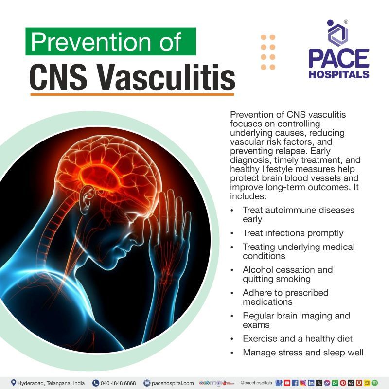 Central Nervous System (CNS) Vasculitis Prevention Central nervous system vasculitis prevention | CNS vasculitis prevention