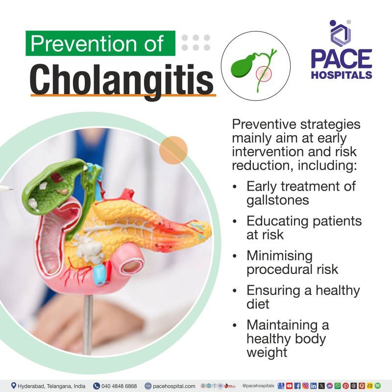 Prevention of Cholangitis Cholangitis Prevention | Prevention of Cholangitis