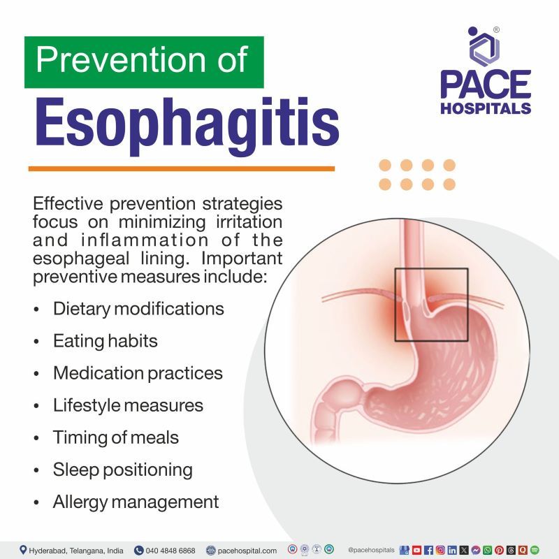 Esophagitis Prevention Esophagitis Prevention | Prevention of Esophagitis