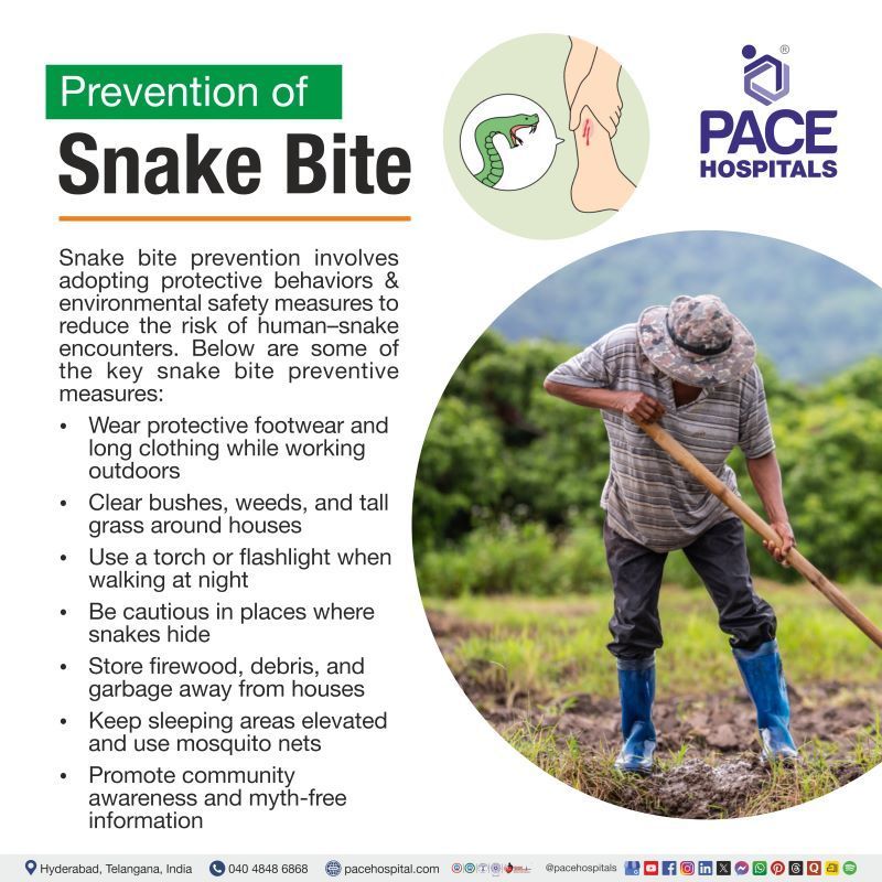 Prevention of Snake Bite Prevention of Snake Bite | Control and prevention of snake bites | Snake bite prevention