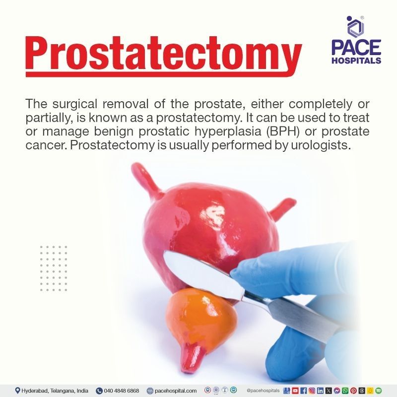 Prostatectomy meaning laparoscopic prostatectomy in Hyderabad | robotic prostatectomy in Hyderabad | prostatectomy surgery cost in Hyderabad | radical prostatectomy in India | open prostatectomy in Telangana | Visual depicting the meaning of prostatectomy procedure
