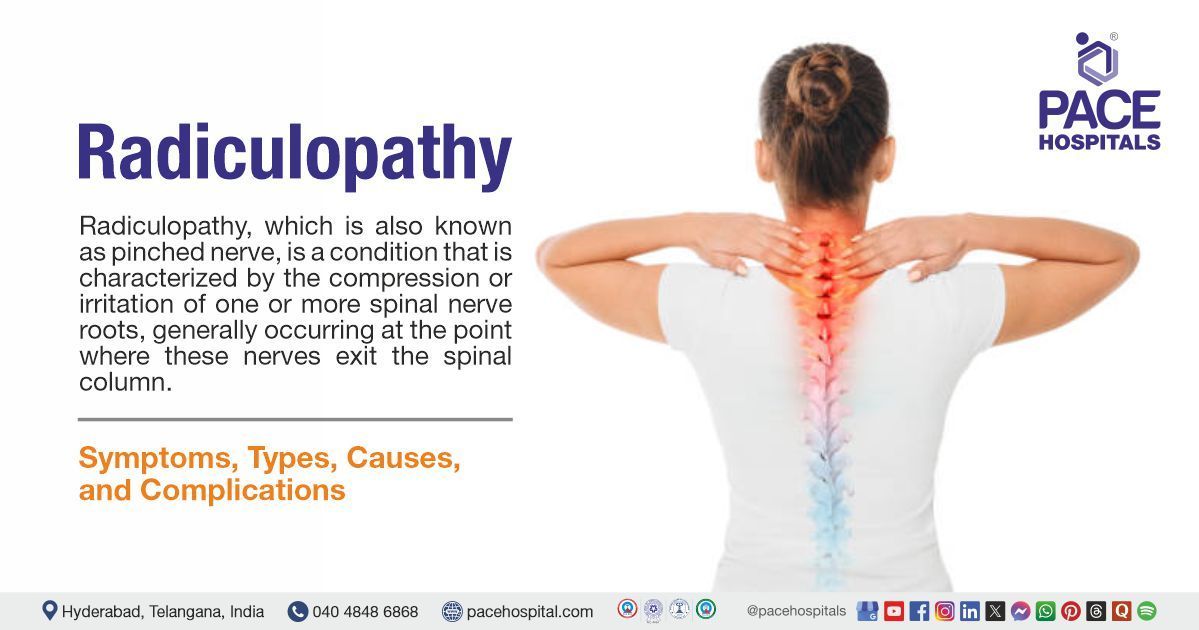 What is radiculopathy | Radiculopathy treatment in India | cervical radiculopathy | radiculopathy l