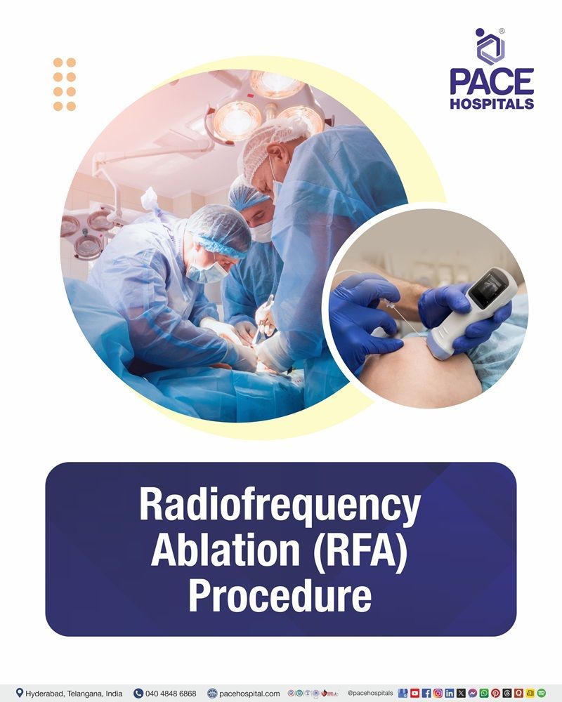 Radiofrequency Ablation (RFA) Cost in Hyderabad | Affordable Radiofrequency Ablation (RFA) Procedure in India