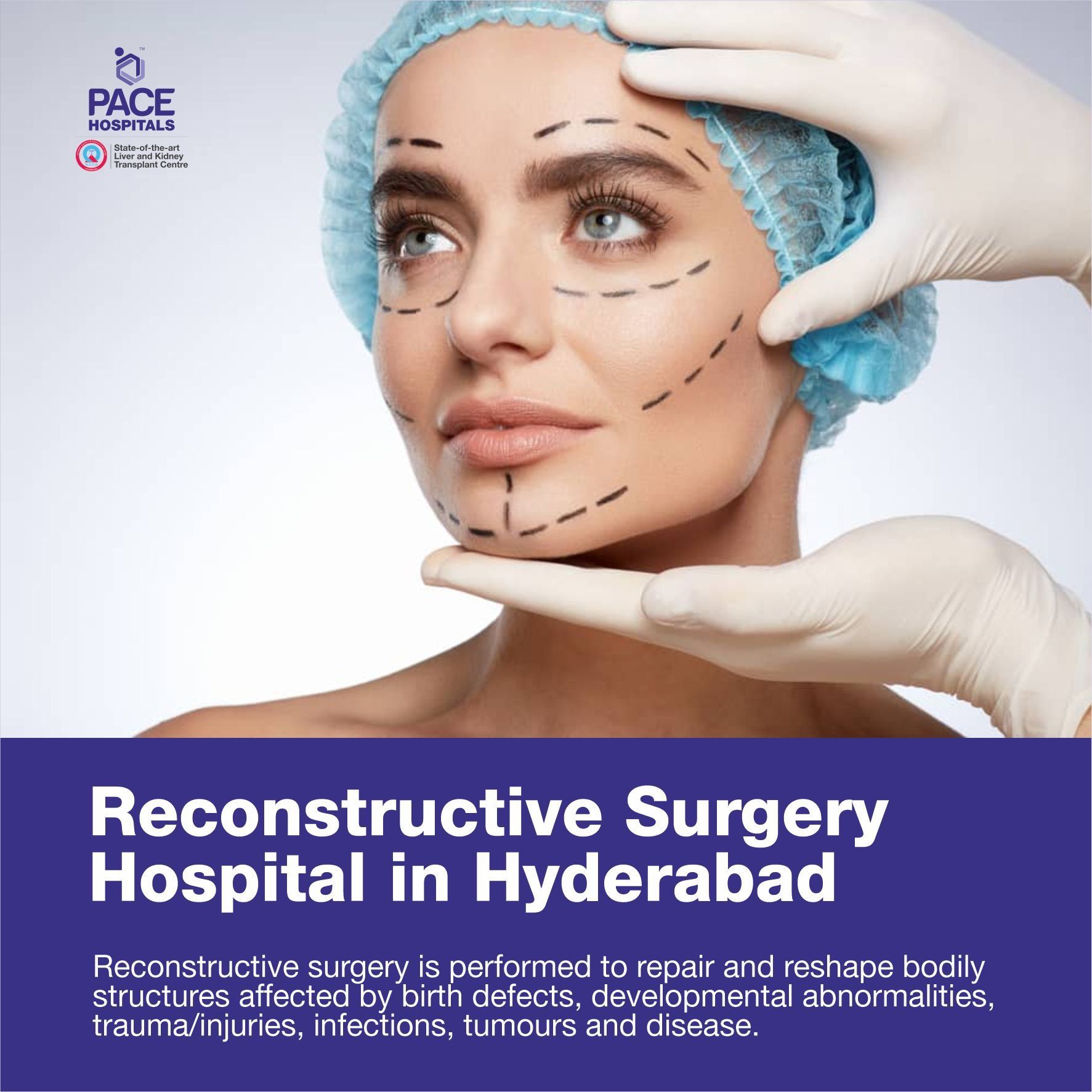 Reconstructive surgery Hospital in Hyderabad - Reconstructive plastic surgery Hospital in Hyderabad