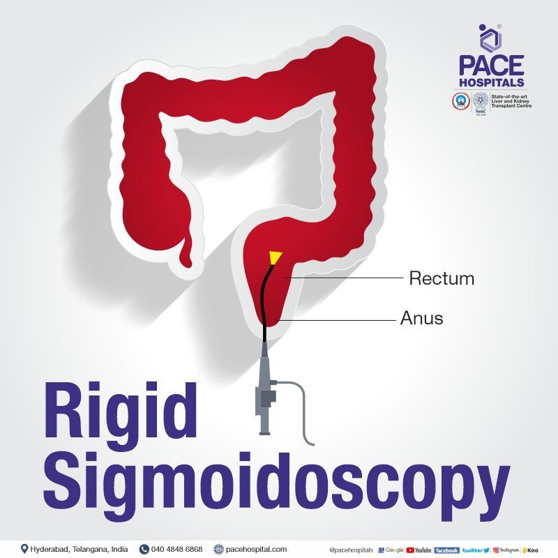 Rigid sigmoidoscopy procedure in Hyderabad and India with test details and scope length explained