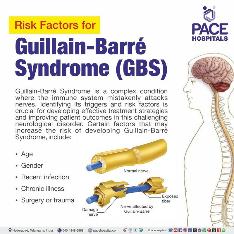 Risk factors of Guillain-Barré syndrome | Visual depicting the Risk factors of Guillain-Barré syndrome