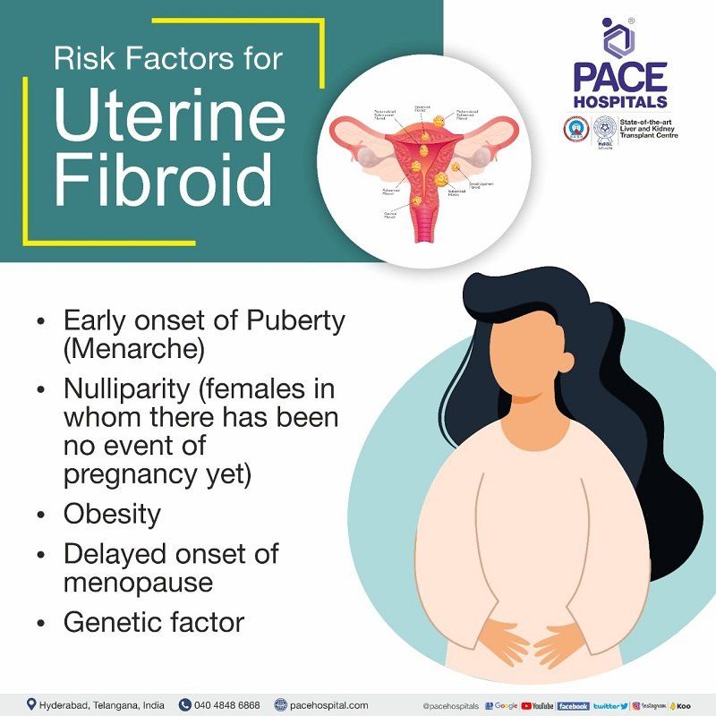 Risk Factors for Uterine Fibroids Risk Factors for Uterine Fibroids