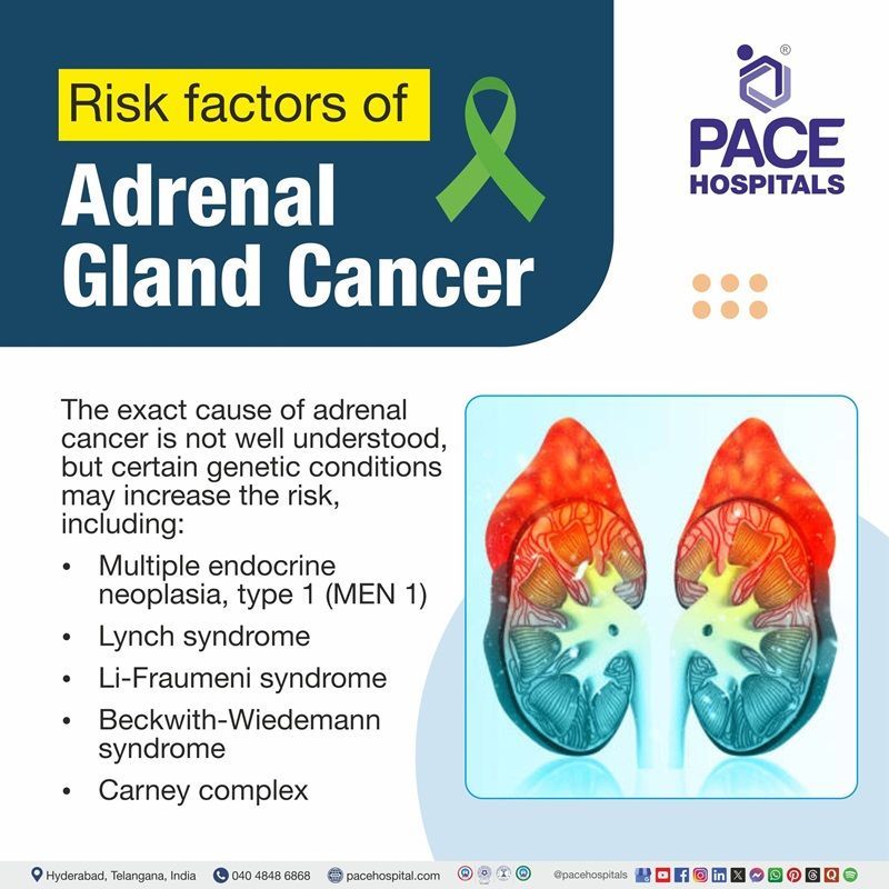 Adrenal cancer risk factors Adrenal cancer risk factors | Visual showing the various risk factors for adrenal cancer