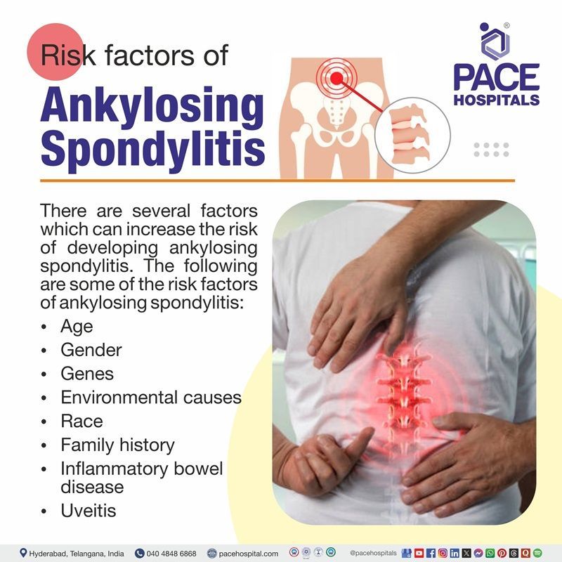 Ankylosing Spondylitis Risk Factors ankylosing spondylitis risk factors | risk factors of ankylosing spondylitis
