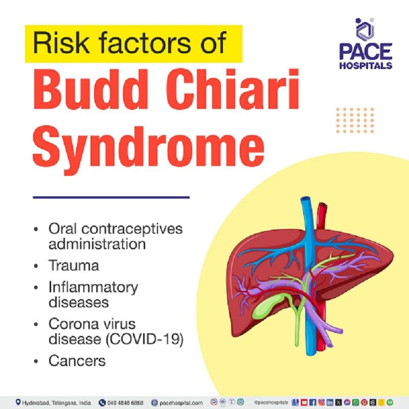 Risk factors of Budd-Chiari Syndrome Risk factors of Budd-Chiari Syndrome | Budd-chiari syndrome risk factors | what are the risk factors of Budd-Chiari syndrome | Visual explaining the risk factors of Budd-Chiari syndrome