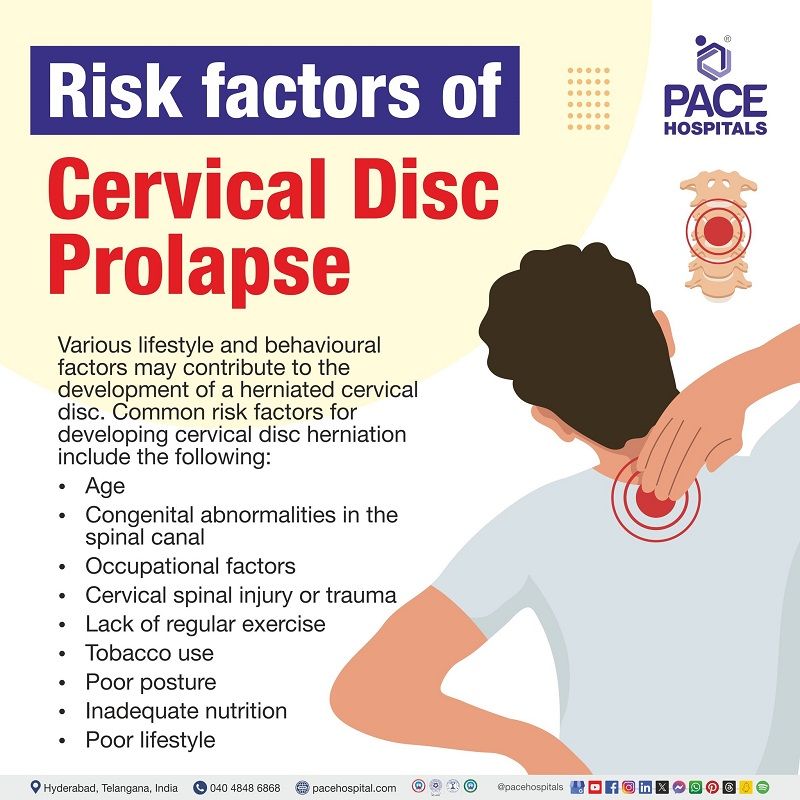 Risk factors of Cervical disc prolapse Risk factors of Cervical disc prolapse | Risk factors of Cervical disc herniation | Cervical disc prolapse Risk factors | what are the risk factors of cervical disc prolapse | disc prolapse risk factors