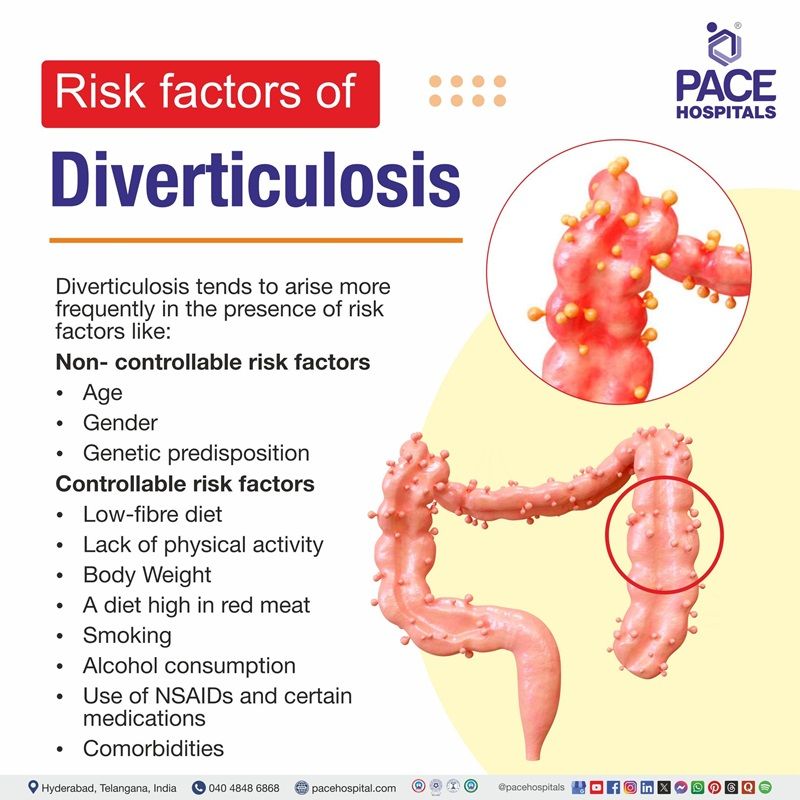 Diverticulosis Risk Factors | Risk Factors of Diverticulosis