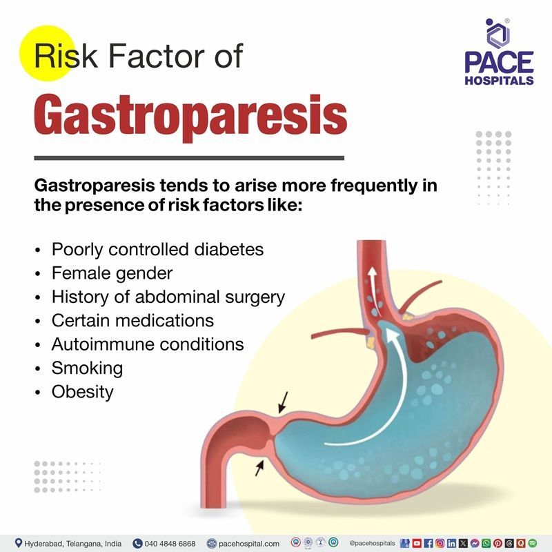 Gastroparesis Risk Factors Risk Factors of Gastroparesis | Gastroparesis Risk Factors