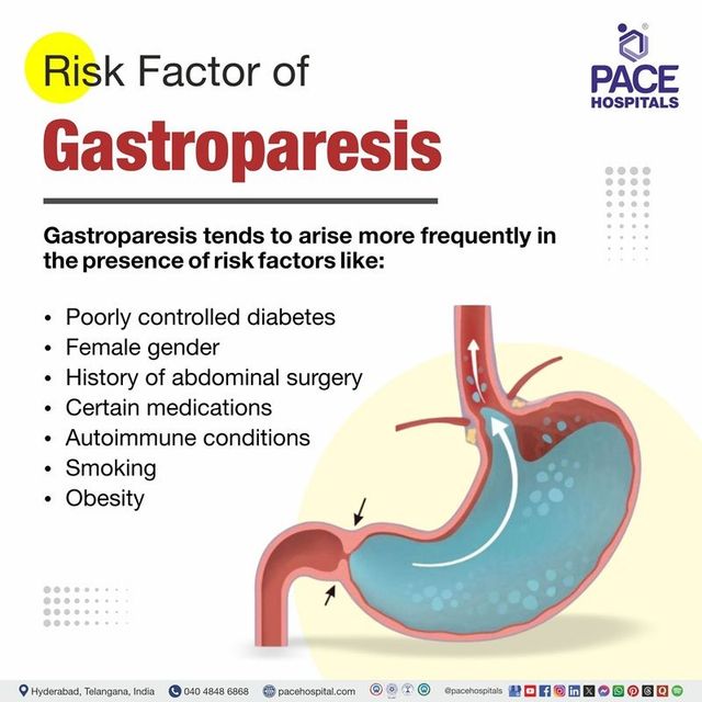 gastroparesis caused by glp 1 Does Ozempic Cause Gastroparesis? [2026 Update] Gastroparesis: when the stomach stops