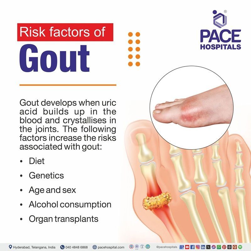 Gout Risk Factors Risk Factors of Gout | Gastroparesis Gout