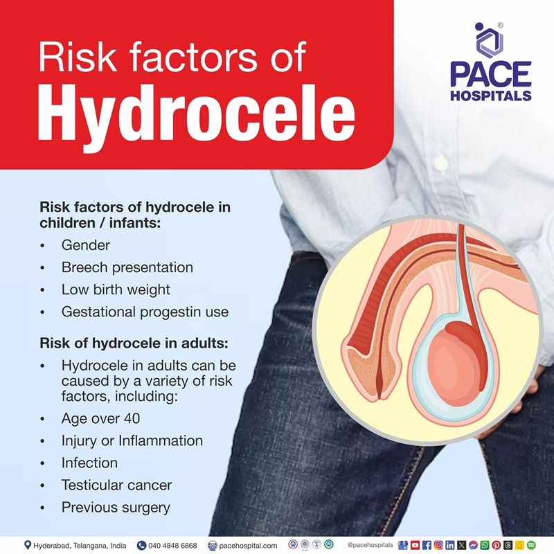 Hydrocele risk factors hydrocele risk factors | risk factor of hydrocele | hydrocele causes risk factors | what are the risk factors of Hydrocele