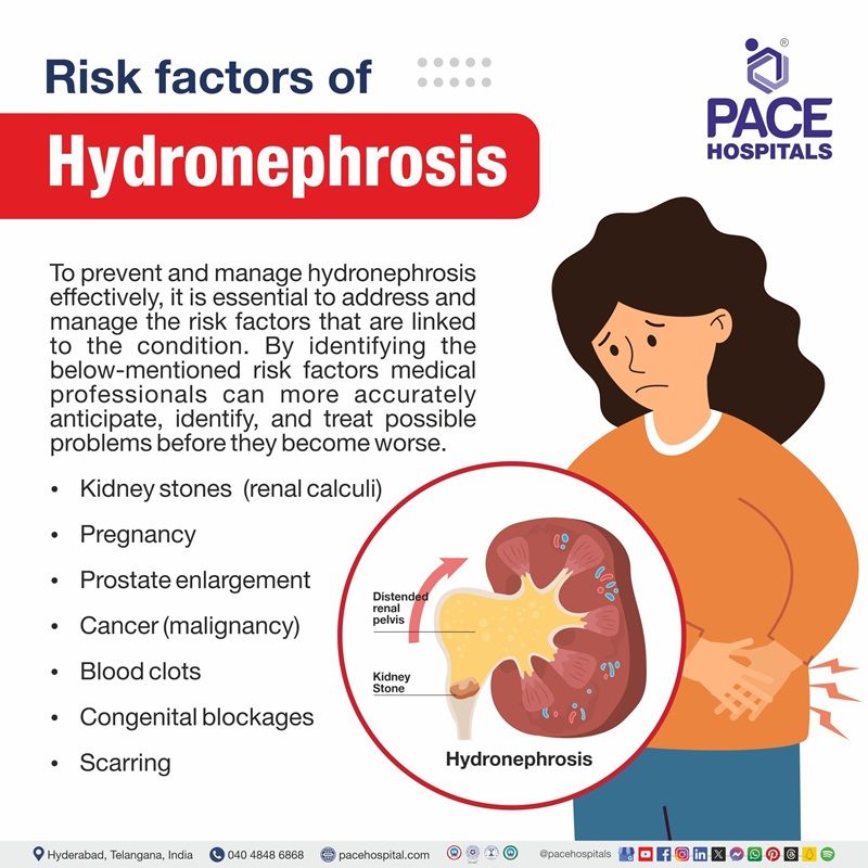 Risk factors of hydronephrosis Kidney hydronephrosis risk factors | risk factors of hydronephrosis