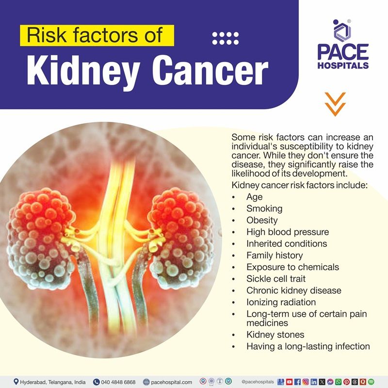 Kidney cancer risk factors Kidney cancer risk factors | Visual depicting the risk factors of kidney cancer