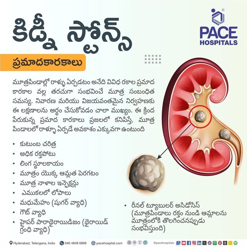 risk factors for kidney stones | risk of kidney stones | Kidney stones risk factors | Visual revealing the risk factors of Kidney stones
