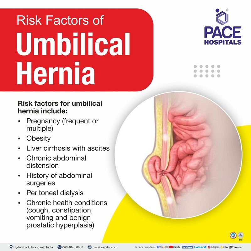 What are the risk factors of Umbilical Hernia risk factors of umbilical hernia, India | paraumbilical hernia risk factors | umbilical hernia risk of strangulation | umbilical hernia risk factors | belly button hernia risk factors