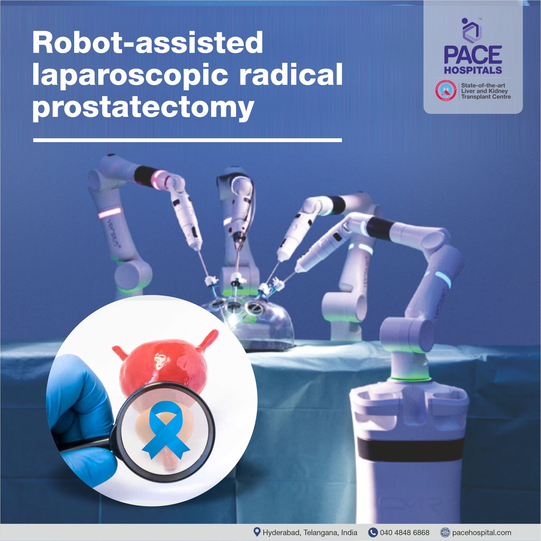 Robot-assisted laparoscopic radical prostatectomy Robot-assisted laparoscopic radical prostatectomy