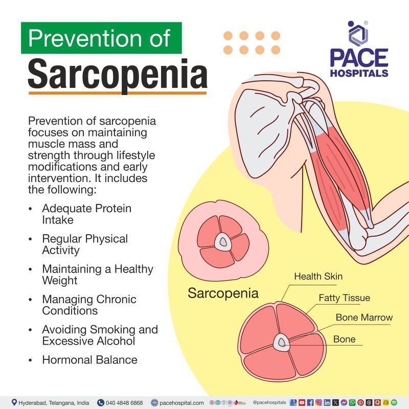 Sarcopenia Prevention | Prevention of Sarcopenia