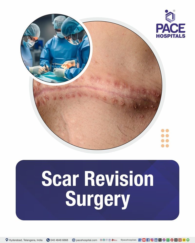 Scar Revision Surgery Cost in Hyderabad | Affordable Scar Revision Surgery in India
