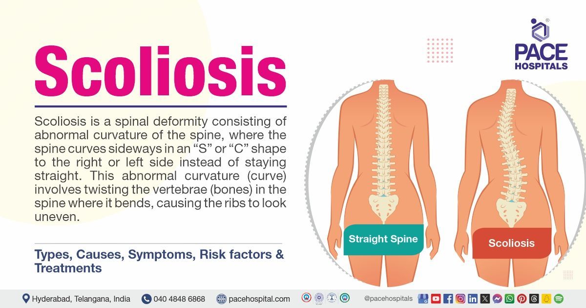 Scoliosis treatment in India | scoliosis meaning | scoliosis causes and Symptoms | scoliosis spine