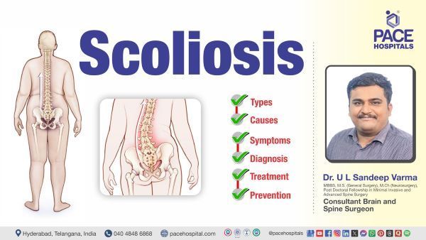 Scoliosis Treatment, Types, Symptoms, Causes Explained by Dr. U L Sandeep Varma from PACE Hospitals