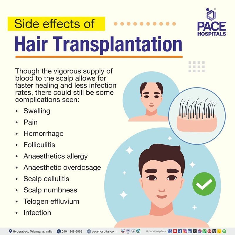 Hair transplant surgery side effects hair transplant side effects | long term side effects of hair transplant | hair transplant treatment side effects | side effects after hair transplant