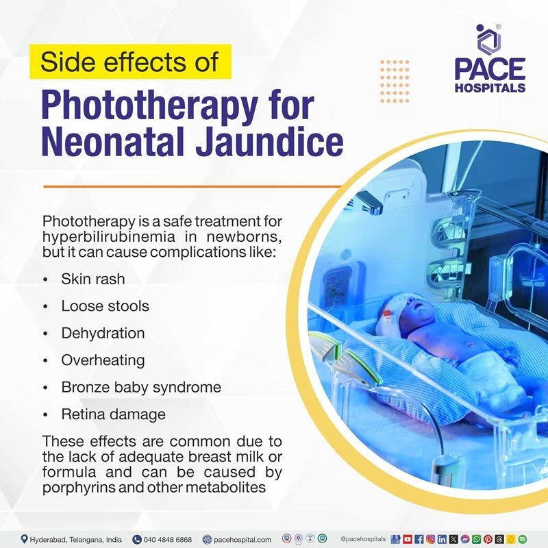 Phototherapy treatment side effects in newborns side effects of phototherapy in newborns | phototherapy for neonatal jaundice side effects | phototherapy side effects baby | phototherapy side effects in newborns