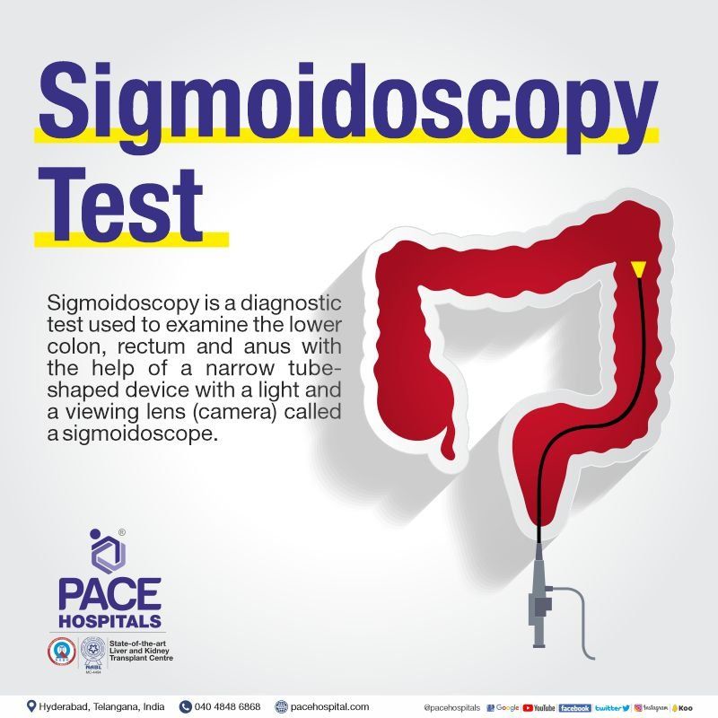 Sigmoidoscopy Test in Hyderabad Sigmoidoscopy test and procedure in Hyderabad, India with cost, meaning and diagnosis details