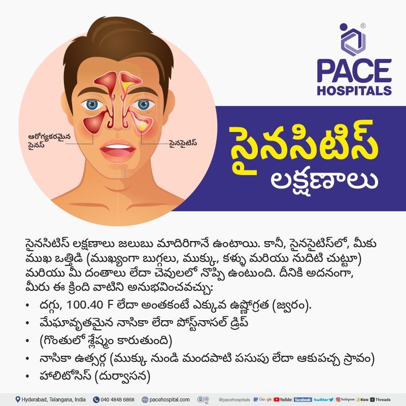 symptoms of sinus in telugu sinusitis symptoms in telugu | sinus infection symptoms in telugu | sinus problem symptoms in telugu | sinus symptoms in telugu