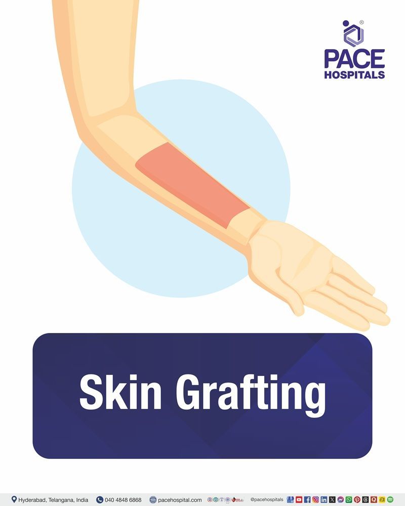 Skin Grafting Surgery Cost in Hyderabad | Affordable Skin Grafting Procedure in India