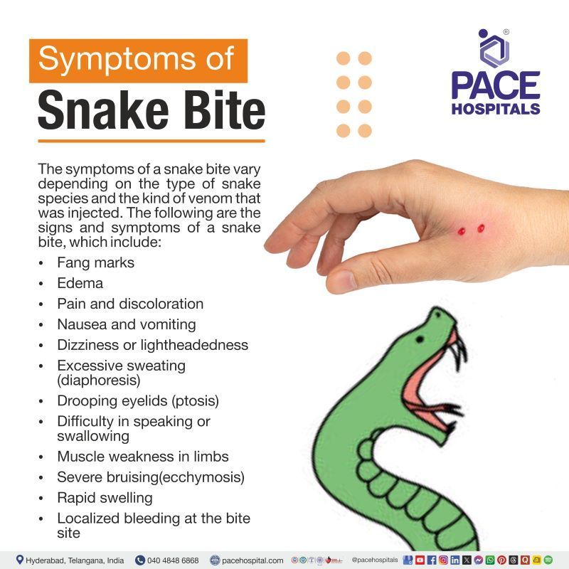 Snake Bite Symptoms Snake Bite Symptoms | Signs and symptoms of snake bite | What are the symptoms of snake bite