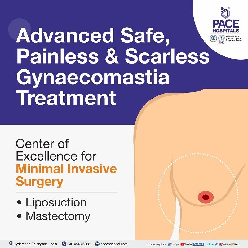 Gynecomastia surgery in Hyderabad Gynecomastia surgery in Hyderabad | Gynaecomastia treatment in Hyderabad