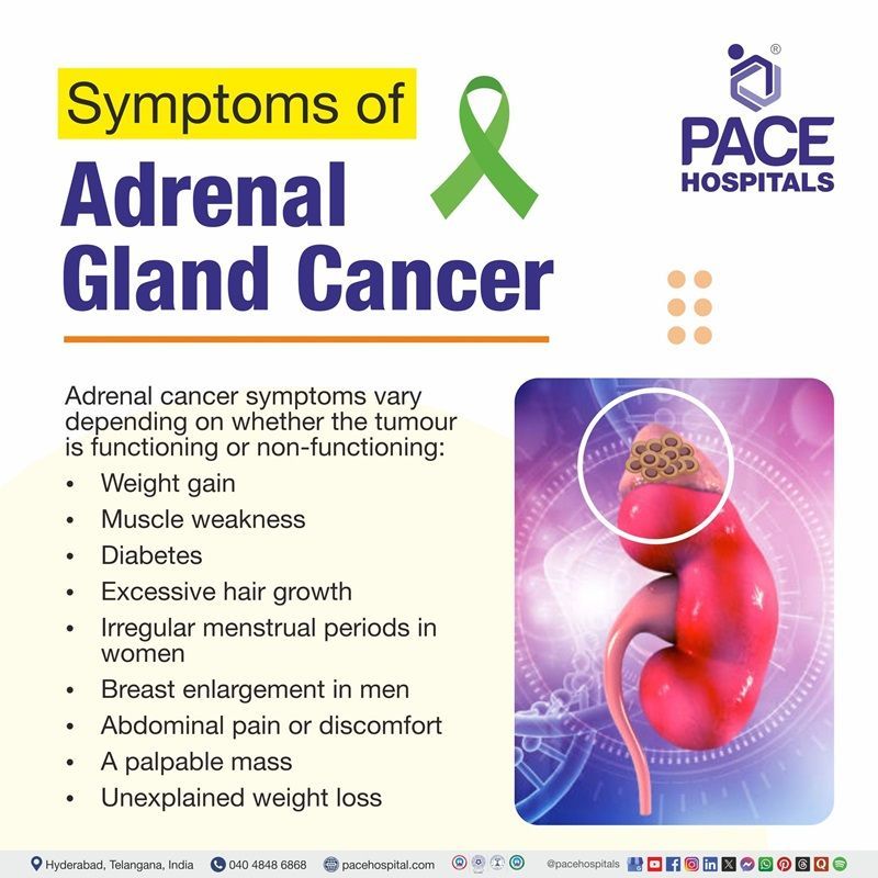 Adrenal cancer symptoms adrenal cancer symptoms | Visual depicting the symptoms of adrenal gland cancer