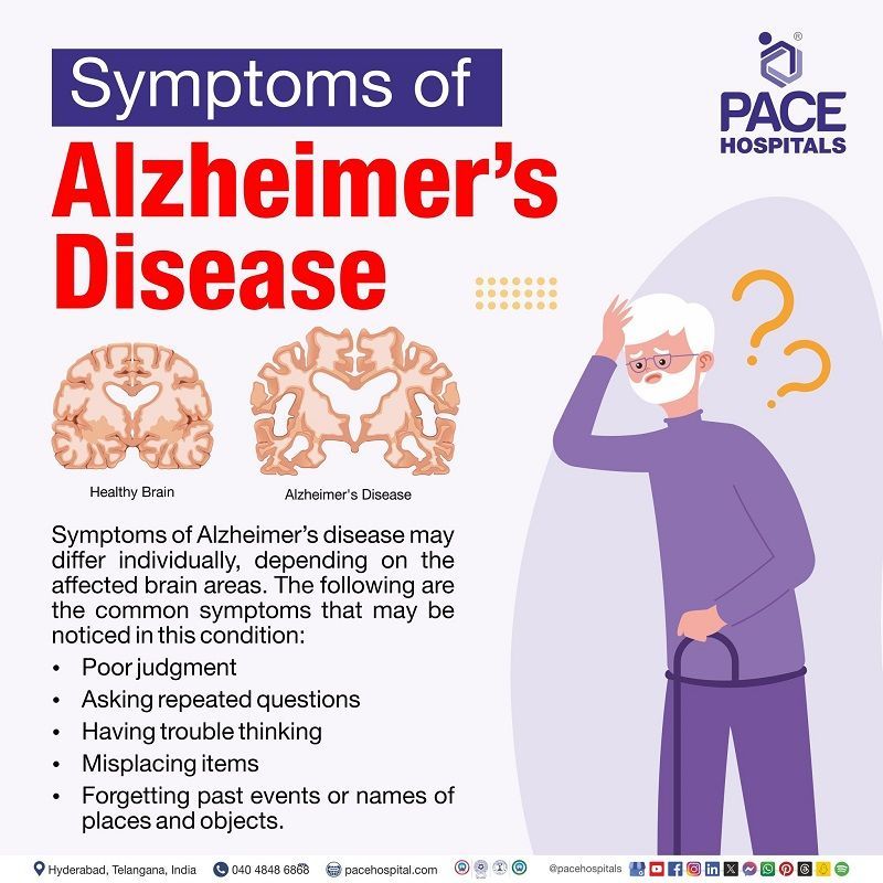 Symptoms of Alzheimer's Disease Alzheimer's disease symptoms | signs and symptoms of Alzheimer's disease | early symptoms of Alzheimer's disease | Visual depicting the symptoms of Alzheimer's Disease