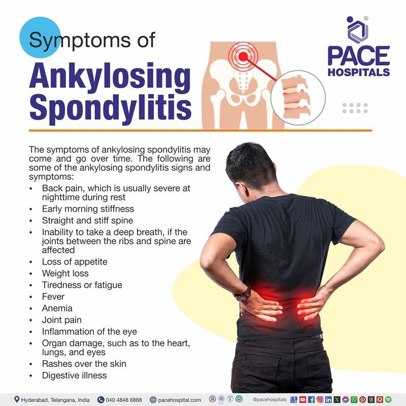Ankylosing Spondylitis Symptoms Ankylosing spondylitis symptoms | ankylosing spondylitis symptoms | females
| ankylosing spondylitis signs and symptoms