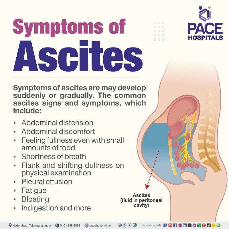 Symptoms of Ascites Symptoms of Ascites | Ascites Symptoms | what are the symptoms of Ascites | ascites signs and symptoms | ascites symptoms female | Visual underlining the symptoms of Ascites