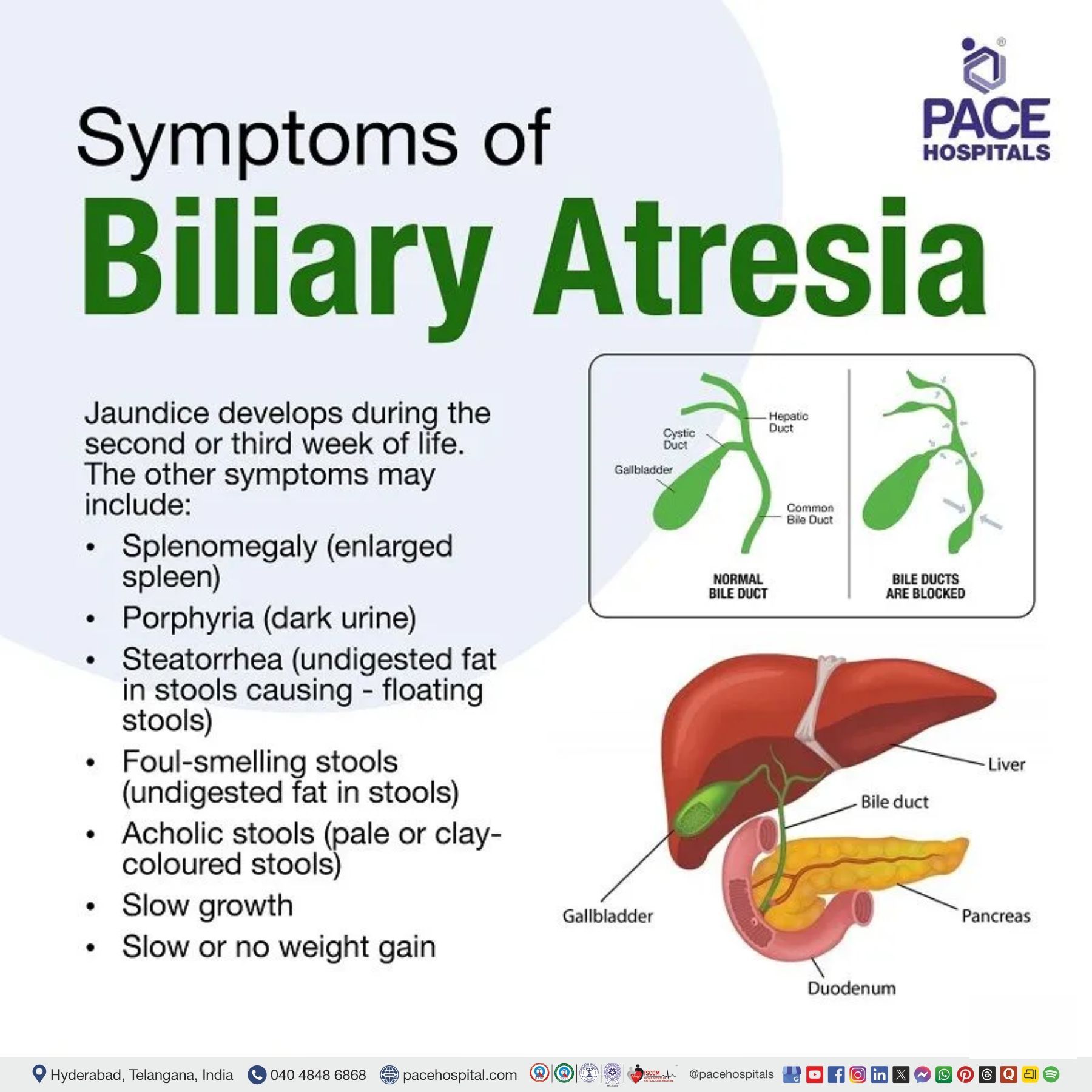 biliary atresia symptoms and signs