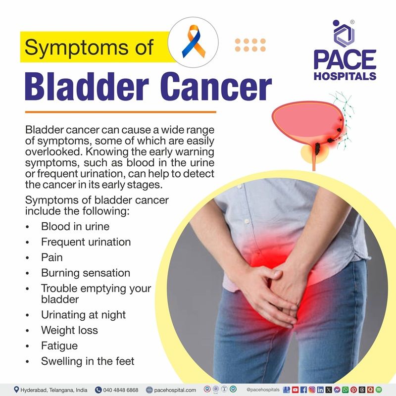 Symptoms of bladder cancer Bladder cancer symptoms | Visual showing the symptoms of bladder cancer