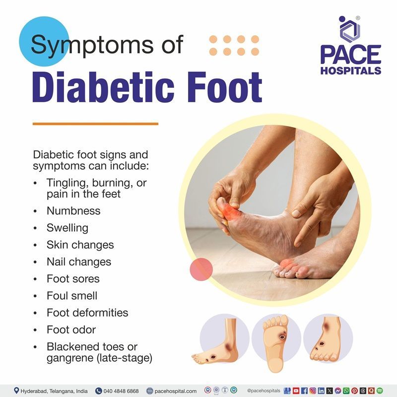 Diabetic Foot Symptoms Diabetic foot signs and symptoms | Image showing the symptoms of diabetic foot