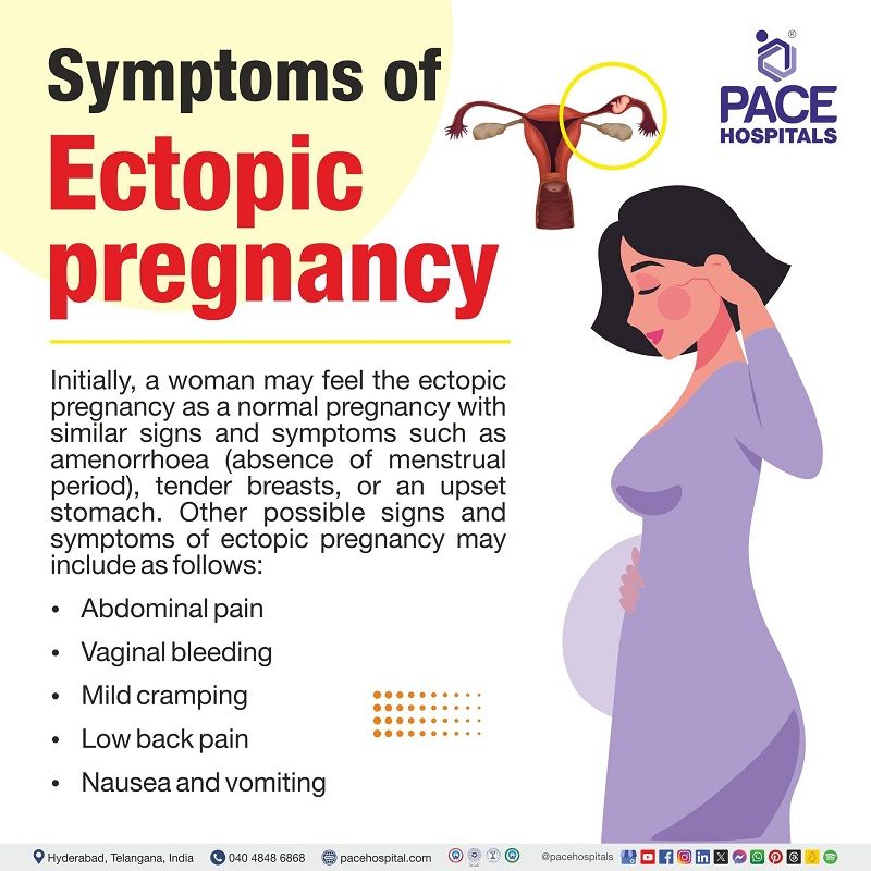 Lets know the symptoms of Ectopic pregnancy Ectopic pregnancy symptoms | signs & symptoms of ectopic pregnancy | symptoms of ectopic pregnancy | Early symptoms of ectopic pregnancy | ectopic pregnancy signs and symptoms