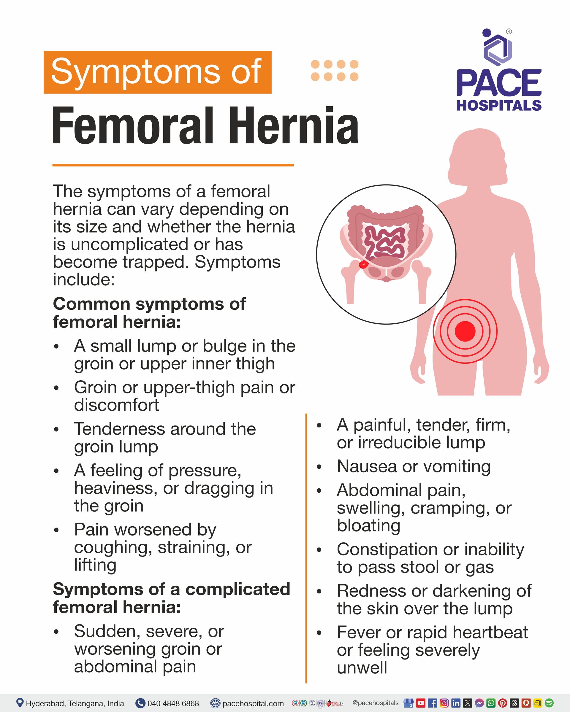 Symptoms of Femoral Hernia Femoral Hernia Symptoms I femoral hernia signs and symptoms I femoral hernia symptoms male I femoral hernia symptoms female