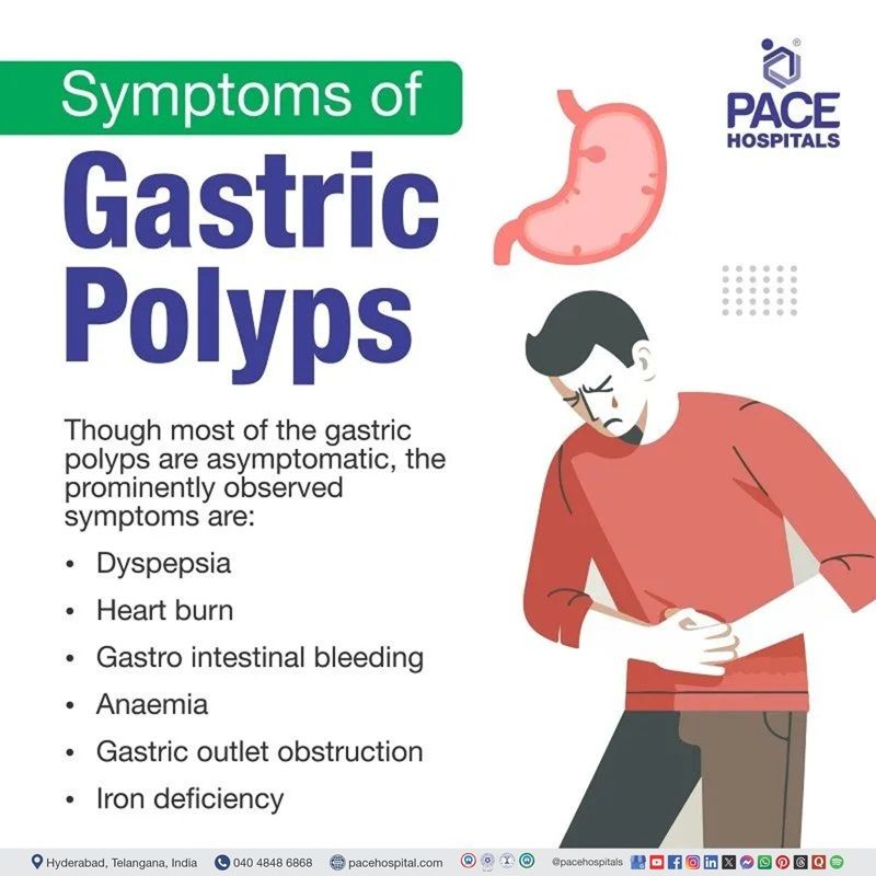 gastric polyps symptoms​ | Visual depicting the symptoms of gastric cancer